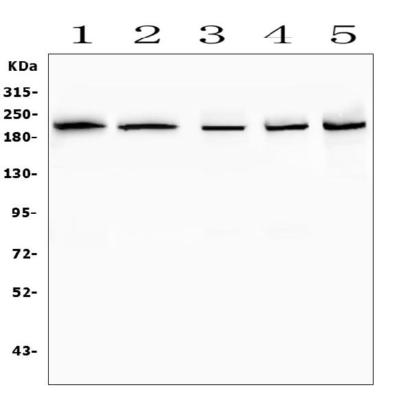 Figure 4. Western blot analysis of SMARCA2 using anti-SMARCA2 antibody (A01888-2). Electrophoresis was performed on a 5-20% SDS-PAGE gel at 70V (Stacking gel) / 90V (Resolving gel) for 2-3 hours. The sample well of each lane was loaded with 50ug of sample under reducing conditions. Lane 1: human HL-60 whole cell lysates, Lane 2: human THP-1 whole cell lysates, Lane 3: human A549whole cell lysates, Lane 4: human U2OS whole cell lysates, Lane 5: human Hela whole cell lysates. After Electrophoresis, proteins were transferred to a Nitrocellulose membrane at 150mA for 50-90 minutes. Blocked the membrane with 5% Non-fat Milk/ TBS for 1.5 hour at RT. The membrane was incubated with rabbit anti-SMARCA2 antigen affinity purified polyclonal antibody (Catalog # A01888-2) at 0.5 microg/mL overnight at 4°C, then washed with TBS-0.1%Tween 3 times with 5 minutes each and probed with a goat anti-rabbit IgG-HRP secondary antibody at a dilution of 1:10000 for 1.5 hour at RT. The signal is developed using an Enhanced Chemiluminescent detection (ECL) kit (Catalog # EK1002) with Tanon 5200 system. A specific band was detected for SMARCA2 at approximately 210KD. The expected band size for SMARCA2 is at 181KD.