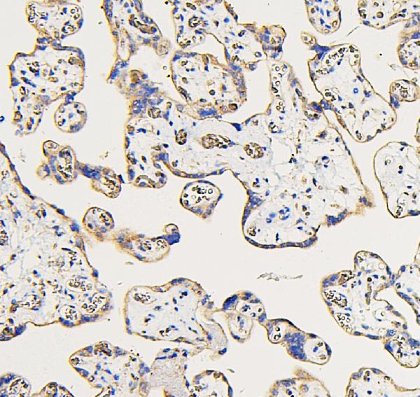 Figure 1. IHC analysis of IFNAR2 using anti-IFNAR2 antibody (A02056-3). IFNAR2 was detected in paraffin-embedded section of human placenta tissues. Heat mediated antigen retrieval was performed in citrate buffer (pH6, epitope retrieval solution) for 20 mins. The tissue section was blocked with 10% goat serum. The tissue section was then incubated with 1microg/ml rabbit anti-IFNAR2 Antibody (A02056-3) overnight at 4°C. Biotinylated goat anti-rabbit IgG was used as secondary antibody and incubated for 30 minutes at 37°C. The tissue section was developed using Strepavidin-Biotin-Complex (SABC)(Catalog # SA1022) with DAB as the chromogen.