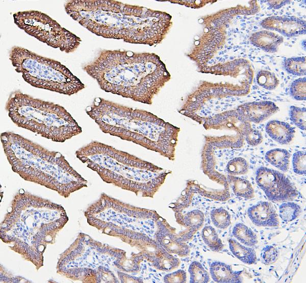 Figure 2. IHC analysis of IFNAR2 using anti-IFNAR2 antibody (A02056-3). IFNAR2 was detected in paraffin-embedded section of mouse intestine tissues. Heat mediated antigen retrieval was performed in citrate buffer (pH6, epitope retrieval solution) for 20 mins. The tissue section was blocked with 10% goat serum. The tissue section was then incubated with 1microg/ml rabbit anti-IFNAR2 Antibody (A02056-3) overnight at 4°C. Biotinylated goat anti-rabbit IgG was used as secondary antibody and incubated for 30 minutes at 37°C. The tissue section was developed using Strepavidin-Biotin-Complex (SABC)(Catalog # SA1022) with DAB as the chromogen. Figure 2. IHC analysis of IFNAR2 using anti-IFNAR2 antibody (A02056-3). IFNAR2 was detected in paraffin-embedded section of mouse intestine tissues. Heat mediated antigen retrieval was performed in citrate buffer (pH6, epitope retrieval solution) for 20 mins. The tissue section was blocked with 10% goat serum. The tissue section was then incubated with 1microg/ml rabbit anti-IFNAR2 Antibody (A02056-3) overnight at 4°C. Biotinylated goat anti-rabbit IgG was used as secondary antibody and incubated for 30 minutes at 37°C. The tissue section was developed using Strepavidin-Biotin-Complex (SABC)(Catalog # SA1022) with DAB as the chromogen.