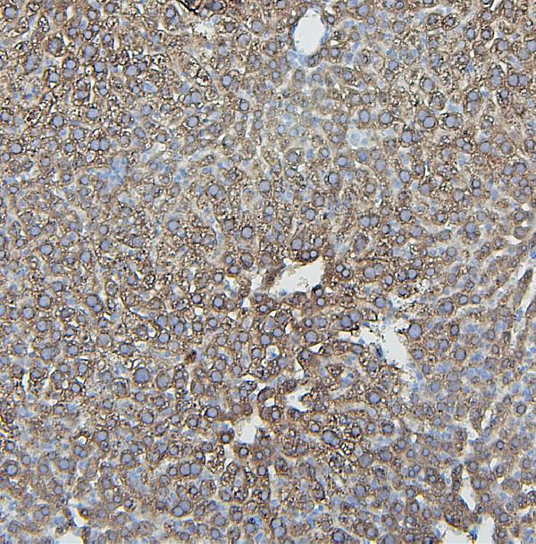 Figure 3. IHC analysis of IFNAR2 using anti-IFNAR2 antibody (A02056-3). IFNAR2 was detected in paraffin-embedded section of mouse liver tissues. Heat mediated antigen retrieval was performed in citrate buffer (pH6, epitope retrieval solution) for 20 mins. The tissue section was blocked with 10% goat serum. The tissue section was then incubated with 1microg/ml rabbit anti-IFNAR2 Antibody (A02056-3) overnight at 4°C. Biotinylated goat anti-rabbit IgG was used as secondary antibody and incubated for 30 minutes at 37°C. The tissue section was developed using Strepavidin-Biotin-Complex (SABC)(Catalog # SA1022) with DAB as the chromogen. Figure 3. IHC analysis of IFNAR2 using anti-IFNAR2 antibody (A02056-3). IFNAR2 was detected in paraffin-embedded section of mouse liver tissues. Heat mediated antigen retrieval was performed in citrate buffer (pH6, epitope retrieval solution) for 20 mins. The tissue section was blocked with 10% goat serum. The tissue section was then incubated with 1microg/ml rabbit anti-IFNAR2 Antibody (A02056-3) overnight at 4°C. Biotinylated goat anti-rabbit IgG was used as secondary antibody and incubated for 30 minutes at 37°C. The tissue section was developed using Strepavidin-Biotin-Complex (SABC)(Catalog # SA1022) with DAB as the chromogen.