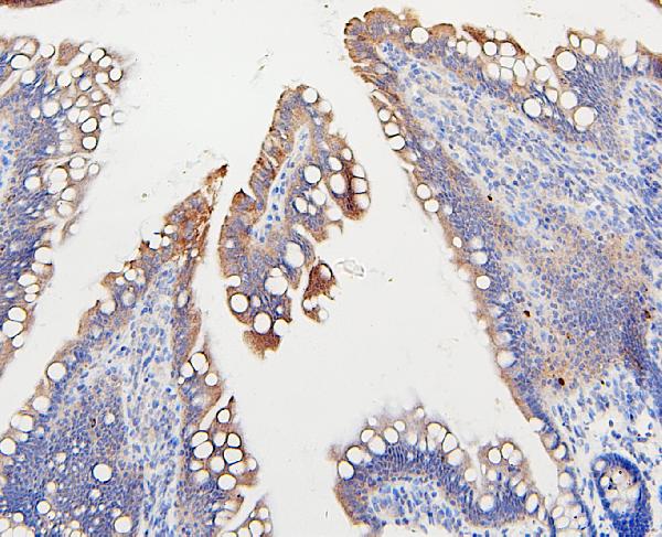 Figure 4. IHC analysis of IFNAR2 using anti-IFNAR2 antibody (A02056-3). IFNAR2 was detected in paraffin-embedded section of rat ntestine tissues. Heat mediated antigen retrieval was performed in citrate buffer (pH6, epitope retrieval solution) for 20 mins. The tissue section was blocked with 10% goat serum. The tissue section was then incubated with 1microg/ml rabbit anti-IFNAR2 Antibody (A02056-3) overnight at 4°C. Biotinylated goat anti-rabbit IgG was used as secondary antibody and incubated for 30 minutes at 37°C. The tissue section was developed using Strepavidin-Biotin-Complex (SABC)(Catalog # SA1022) with DAB as the chromogen. Figure 4. IHC analysis of IFNAR2 using anti-IFNAR2 antibody (A02056-3). IFNAR2 was detected in paraffin-embedded section of rat ntestine tissues. Heat mediated antigen retrieval was performed in citrate buffer (pH6, epitope retrieval solution) for 20 mins. The tissue section was blocked with 10% goat serum. The tissue section was then incubated with 1microg/ml rabbit anti-IFNAR2 Antibody (A02056-3) overnight at 4°C. Biotinylated goat anti-rabbit IgG was used as secondary antibody and incubated for 30 minutes at 37°C. The tissue section was developed using Strepavidin-Biotin-Complex (SABC)(Catalog # SA1022) with DAB as the chromogen.