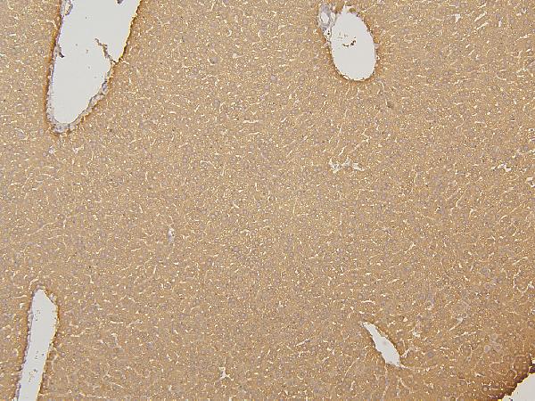 Figure 3. IHC analysis of CYP2C19 using anti-CYP2C19 antibody (A02102-2). CYP2C19 was detected in paraffin-embedded section of mouse liver tissues. Heat mediated antigen retrieval was performed in citrate buffer (pH6, epitope retrieval solution) for 20 mins. The tissue section was blocked with 10% goat serum. The tissue section was then incubated with 1microg/ml rabbit anti-CYP2C19 Antibody (A02102-2) overnight at 4°C. Biotinylated goat anti-rabbit IgG was used as secondary antibody and incubated for 30 minutes at 37°C. The tissue section was developed using Strepavidin-Biotin-Complex (SABC)(Catalog # SA1022) with DAB as the chromogen. Figure 3. IHC analysis of CYP2C19 using anti-CYP2C19 antibody (A02102-2). CYP2C19 was detected in paraffin-embedded section of mouse liver tissues. Heat mediated antigen retrieval was performed in citrate buffer (pH6, epitope retrieval solution) for 20 mins. The tissue section was blocked with 10% goat serum. The tissue section was then incubated with 1microg/ml rabbit anti-CYP2C19 Antibody (A02102-2) overnight at 4°C. Biotinylated goat anti-rabbit IgG was used as secondary antibody and incubated for 30 minutes at 37°C. The tissue section was developed using Strepavidin-Biotin-Complex (SABC)(Catalog # SA1022) with DAB as the chromogen.