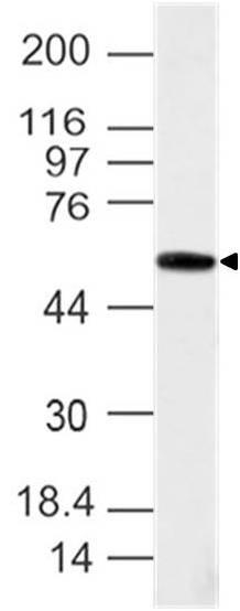 Western blot analysis of Brachyury