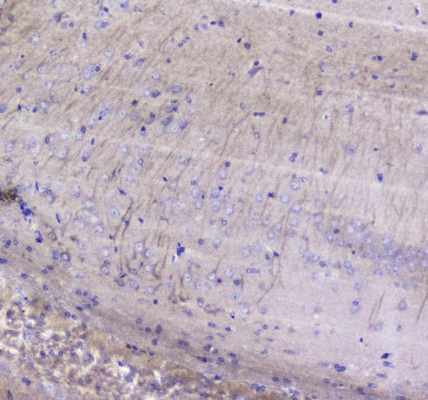A02171 1 Betacellulin primary antibodies IHC testing 4