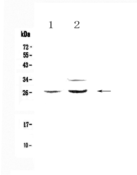  Western blot analysis of Betacellulin using anti-Betacellulin antibody (A02171-1)