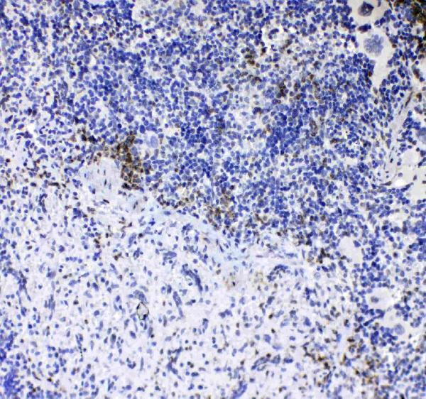 A02236 1 CD8_alpha primary antibodies IHC testing 2
