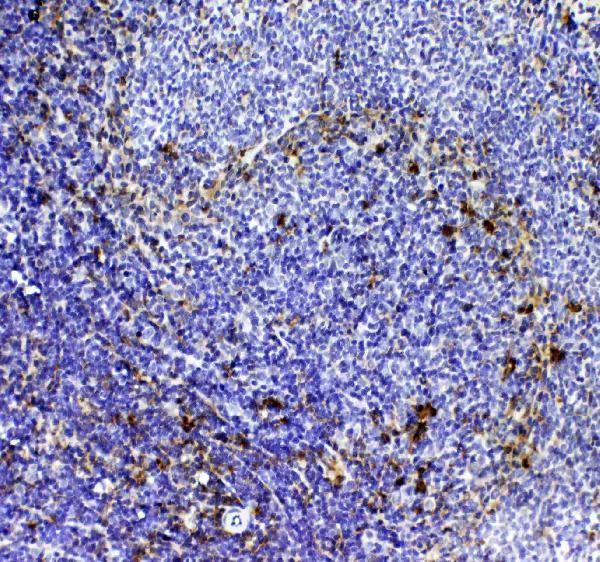 A02236 1 CD8_alpha primary antibodies IHC testing 3