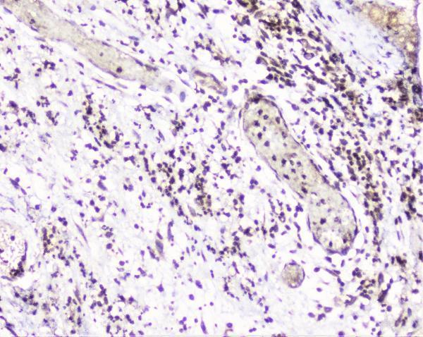 A02295 UBE2I UBC9 primary antibodies IHC testing 2