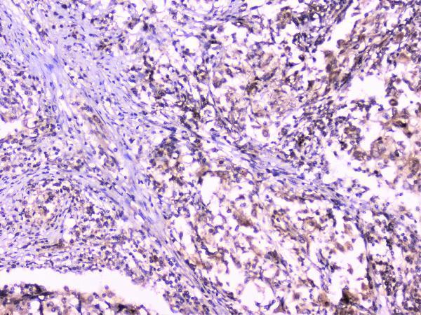 A02295 UBE2I UBC9 primary antibodies IHC testing 3