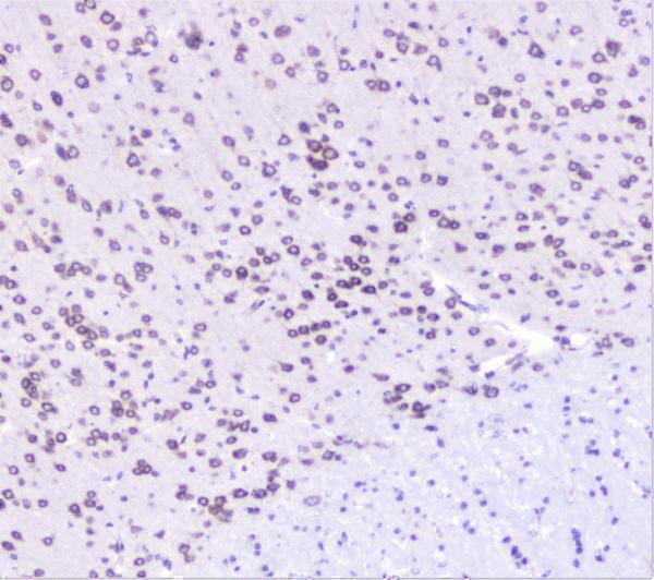A02295 UBE2I UBC9 primary antibodies IHC testing 5