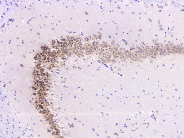 A02295 UBE2I UBC9 primary antibodies IHC testing 6