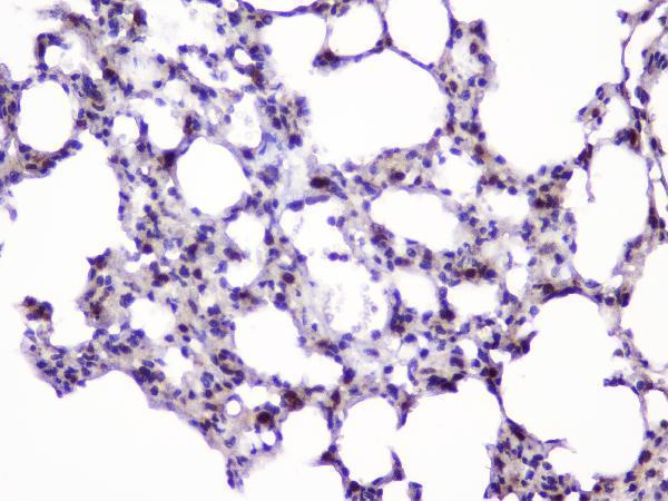 A02295 UBE2I UBC9 primary antibodies IHC testing 7