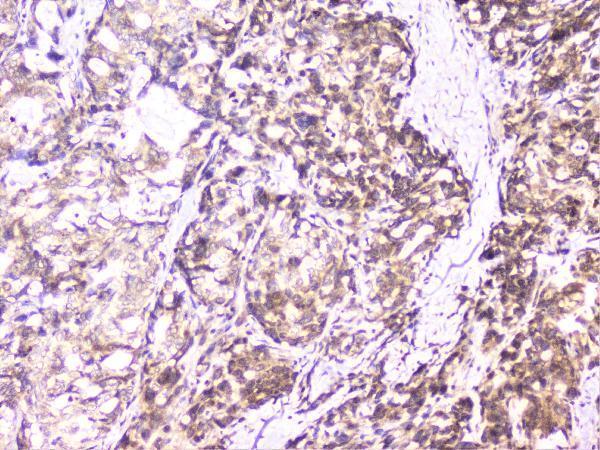 A02295 UBE2I UBC9 primary antibodies IHC testing 8