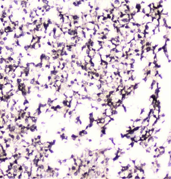 A02295 UBE2I UBC9 primary antibodies IHC testing 9