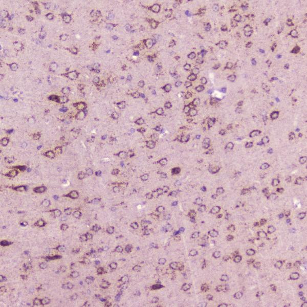 IHC analysis of Calcitonin using anti-Calcitonin antibody (A02352). Calcitonin was detected in paraffin-embedded section of mouse brain tissue. Heat mediated antigen retrieval was performed in citrate buffer (pH6, epitope retrieval solution) for 20 mins. The tissue section was blocked with 10% goat serum. The tissue section was then incubated with 2μg/ml rabbit anti-Calcitonin Antibody (A02352) overnight at 4℃. Biotinylated goat anti-rabbit IgG was used as secondary antibody and incubated for 30 minutes at 37℃. The tissue section was developed using Strepavidin-Biotin-Complex (SABC)(Catalog # SA1022) with DAB as the chromogen.
