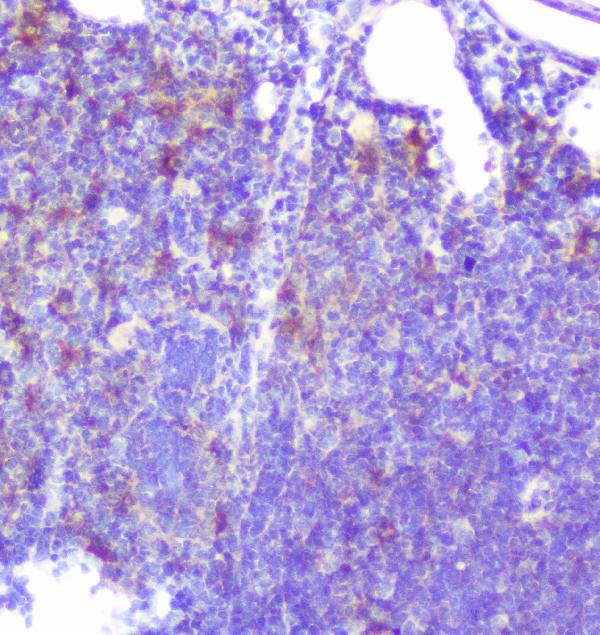 IHC analysis of Caspase-2 using anti-Caspase-2 antibody (A02384-1). Caspase-2 was detected in paraffin-embedded section of mouse intestine tissue. Heat mediated antigen retrieval was performed in citrate buffer (pH6, epitope retrieval solution) for 20 mins. The tissue section was blocked with 10% goat serum. The tissue section was then incubated with 1μg/ml rabbit anti-Caspase-2 Antibody (A02384-1) overnight at 4°C. Biotinylated goat anti-rabbit IgG was used as secondary antibody and incubated for 30 minutes at 37°C. The tissue section was developed using Strepavidin-Biotin-Complex (SABC)(Catalog # SA1022) with DAB as the chromogen.