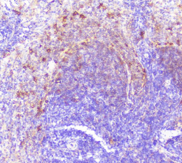 IHC analysis of Caspase-2 using anti-Caspase-2 antibody (A02384-1). Caspase-2 was detected in paraffin-embedded section of rat spleen tissue. Heat mediated antigen retrieval was performed in citrate buffer (pH6, epitope retrieval solution) for 20 mins. The tissue section was blocked with 10% goat serum. The tissue section was then incubated with 1μg/ml rabbit anti-Caspase-2 Antibody (A02384-1) overnight at 4°C. Biotinylated goat anti-rabbit IgG was used as secondary antibody and incubated for 30 minutes at 37°C. The tissue section was developed using Strepavidin-Biotin-Complex (SABC)(Catalog # SA1022) with DAB as the chromogen.