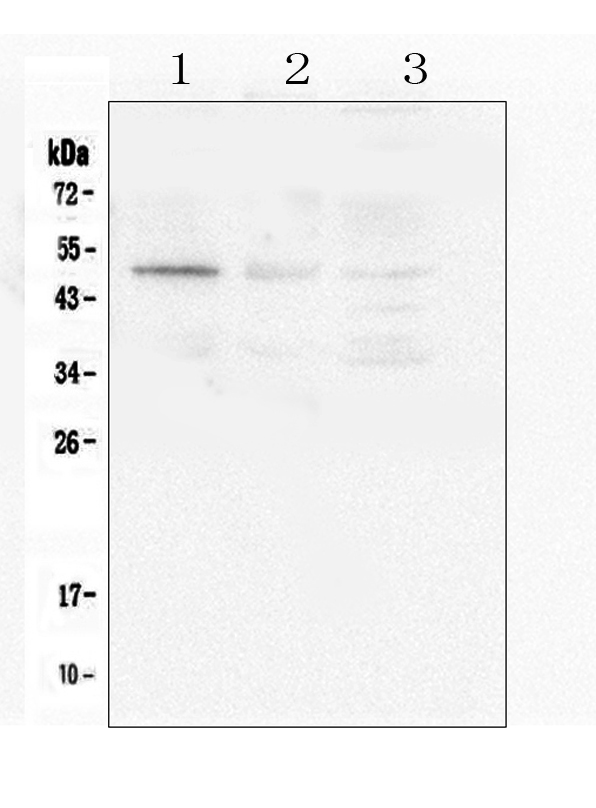 Western blot analysis of Caspase-2 using anti-Caspase-2 antibody (A02384-1). Electrophoresis was performed on a 5-20% SDS-PAGE gel at 70V (Stacking gel) / 90V (Resolving gel) for 2-3 hours. The sample well of each lane was loaded with 50ug of sample under reducing conditions. Lane 1: human PANC-1 whole cell lysate, Lane 2: human 22RV1 whole cell lysate, Lane 3: human SGC-7901 whole cell lysate. After Electrophoresis, proteins were transferred to a Nitrocellulose membrane at 150mA for 50-90 minutes. Blocked the membrane with 5% Non-fat Milk/ TBS for 1.5 hour at RT. The membrane was incubated with rabbit anti-Caspase-2 antigen affinity purified polyclonal antibody (Catalog # A02384-1) at 0.5 μg/mL overnight at 4°C, then washed with TBS-0.1%Tween 3 times with 5 minutes each and probed with a goat anti-rabbit IgG-HRP secondary antibody at a dilution of 1:10000 for 1.5 hour at RT. The signal is developed using an Enhanced Chemiluminescent detection (ECL) kit (Catalog # EK1002) with Tanon 5200 system. A specific band was detected for Caspase-2 at approximately 51KD. The expected band size for Caspase-2 is at 51KD.