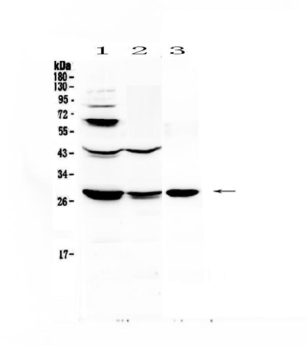 Western blot analysis of TL1A using anti-TL1A antibody (A02402-1).