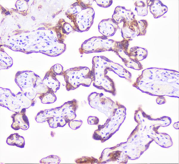 IHC analysis of COMP using anti-COMP antibody (A02443-1). COMP was detected in paraffin-embedded section of human placenta tissue. Heat mediated antigen retrieval was performed in citrate buffer (pH6, epitope retrieval solution) for 20 mins. The tissue section was blocked with 10% goat serum. The tissue section was then incubated with 1μg/ml rabbit anti-COMP Antibody (A02443-1) overnight at 4°C. Biotinylated goat anti-rabbit IgG was used as secondary antibody and incubated for 30 minutes at 37°C. The tissue section was developed using Strepavidin-Biotin-Complex (SABC)(Catalog # SA1022) with DAB as the chromogen.