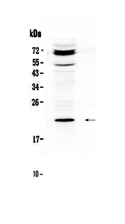 Western blot analysis of C19orf80 using anti-C19orf80 antibody (A02471).