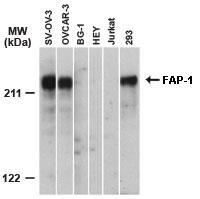 Western blot analysis of FAP-1 using primary antibody dilution ratio of 1:2000