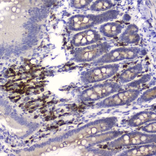 Figure 2. IHC analysis of HE4 using anti-HE4 antibody (A02685-4). HE4 was detected in paraffin-embedded section of rat small intestine tissue. Heat mediated antigen retrieval was performed in citrate buffer (pH6, epitope retrieval solution) for 20 mins. The tissue section was blocked with 10% goat serum. The tissue section was then incubated with 2microg/ml rabbit anti-HE4 Antibody (A02685-4) overnight at 4°C. Biotinylated goat anti-rabbit IgG was used as secondary antibody and incubated for 30 minutes at 37°C. The tissue section was developed using Strepavidin-Biotin-Complex (SABC)(Catalog # SA1022) with DAB as the chromogen. Figure 2. IHC analysis of HE4 using anti-HE4 antibody (A02685-4). HE4 was detected in paraffin-embedded section of rat small intestine tissue. Heat mediated antigen retrieval was performed in citrate buffer (pH6, epitope retrieval solution) for 20 mins. The tissue section was blocked with 10% goat serum. The tissue section was then incubated with 2microg/ml rabbit anti-HE4 Antibody (A02685-4) overnight at 4°C. Biotinylated goat anti-rabbit IgG was used as secondary antibody and incubated for 30 minutes at 37°C. The tissue section was developed using Strepavidin-Biotin-Complex (SABC)(Catalog # SA1022) with DAB as the chromogen.