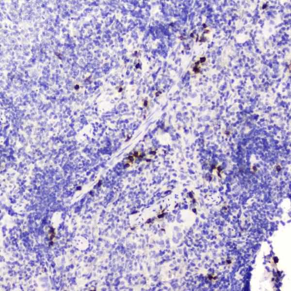 IHC analysis of HE4 using anti-HE4 antibody (A02685-4). HE4 was detected in paraffin-embedded section of mouse spleen tissue. Heat mediated antigen retrieval was performed in citrate buffer (pH6, epitope retrieval solution) for 20 mins. The tissue section was blocked with 10% goat serum. The tissue section was then incubated with 2μg/ml rabbit anti-HE4 Antibody (A02685-4) overnight at 4℃. Biotinylated goat anti-rabbit IgG was used as secondary antibody and incubated for 30 minutes at 37℃. The tissue section was developed using Strepavidin-Biotin-Complex (SABC)(Catalog # SA1022) with DAB as the chromogen.