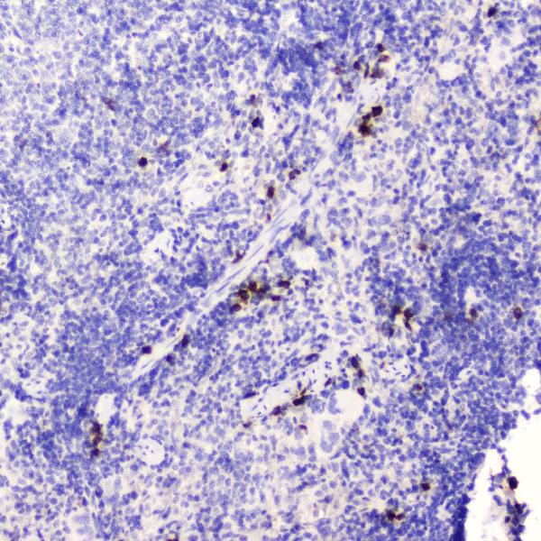 Figure 3. IHC analysis of HE4 using anti-HE4 antibody (A02685-4). HE4 was detected in paraffin-embedded section of mouse spleen tissue . Heat mediated antigen retrieval was performed in citrate buffer (pH6, epitope retrieval solution) for 20 mins. The tissue section was blocked with 10% goat serum. The tissue section was then incubated with 2microg/ml rabbit anti-HE4 Antibody (A02685-4) overnight at 4°C. Biotinylated goat anti-rabbit IgG was used as secondary antibody and incubated for 30 minutes at 37°C. The tissue section was developed using Strepavidin-Biotin-Complex (SABC)(Catalog # SA1022) with DAB as the chromogen. Figure 3. IHC analysis of HE4 using anti-HE4 antibody (A02685-4). HE4 was detected in paraffin-embedded section of mouse spleen tissue . Heat mediated antigen retrieval was performed in citrate buffer (pH6, epitope retrieval solution) for 20 mins. The tissue section was blocked with 10% goat serum. The tissue section was then incubated with 2microg/ml rabbit anti-HE4 Antibody (A02685-4) overnight at 4°C. Biotinylated goat anti-rabbit IgG was used as secondary antibody and incubated for 30 minutes at 37°C. The tissue section was developed using Strepavidin-Biotin-Complex (SABC)(Catalog # SA1022) with DAB as the chromogen.