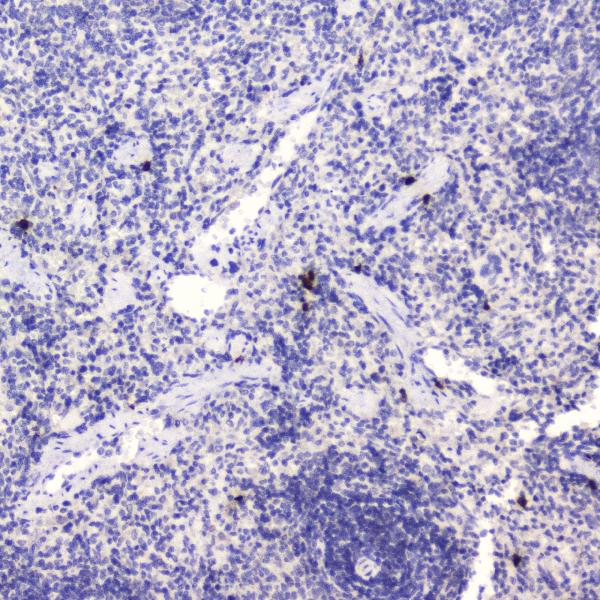 IHC analysis of HE4 using anti-HE4 antibody (A02685-4). HE4 was detected in paraffin-embedded section of rat spleen tissue. Heat mediated antigen retrieval was performed in citrate buffer (pH6, epitope retrieval solution) for 20 mins. The tissue section was blocked with 10% goat serum. The tissue section was then incubated with 2μg/ml rabbit anti-HE4 Antibody (A02685-4) overnight at 4°C. Biotinylated goat anti-rabbit IgG was used as secondary antibody and incubated for 30 minutes at 37°C. The tissue section was developed using Strepavidin-Biotin-Complex (SABC)(Catalog # SA1022) with DAB as the chromogen.