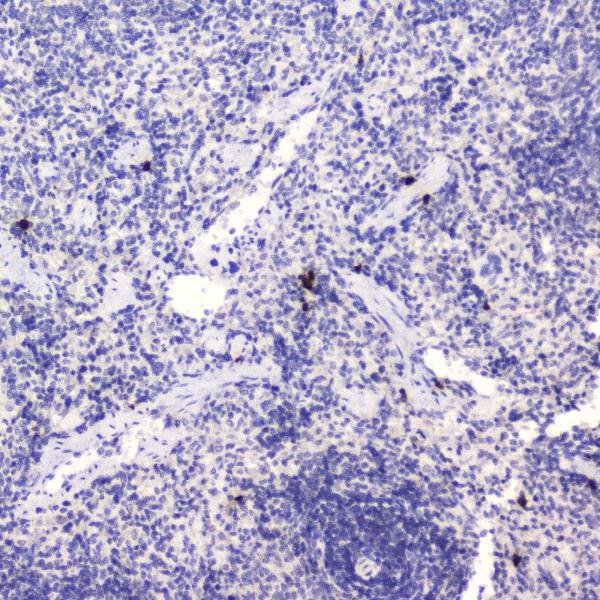 Figure 4. IHC analysis of HE4 using anti-HE4 antibody (A02685-4). HE4 was detected in paraffin-embedded section of rat spleen tissue . Heat mediated antigen retrieval was performed in citrate buffer (pH6, epitope retrieval solution) for 20 mins. The tissue section was blocked with 10% goat serum. The tissue section was then incubated with 2microg/ml rabbit anti-HE4 Antibody (A02685-4) overnight at 4°C. Biotinylated goat anti-rabbit IgG was used as secondary antibody and incubated for 30 minutes at 37°C. The tissue section was developed using Strepavidin-Biotin-Complex (SABC)(Catalog # SA1022) with DAB as the chromogen. Figure 4. IHC analysis of HE4 using anti-HE4 antibody (A02685-4). HE4 was detected in paraffin-embedded section of rat spleen tissue . Heat mediated antigen retrieval was performed in citrate buffer (pH6, epitope retrieval solution) for 20 mins. The tissue section was blocked with 10% goat serum. The tissue section was then incubated with 2microg/ml rabbit anti-HE4 Antibody (A02685-4) overnight at 4°C. Biotinylated goat anti-rabbit IgG was used as secondary antibody and incubated for 30 minutes at 37°C. The tissue section was developed using Strepavidin-Biotin-Complex (SABC)(Catalog # SA1022) with DAB as the chromogen.