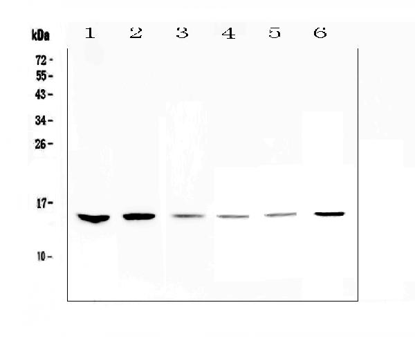 Western blot analysis of HE4 using anti-HE4 antibody (A02685-4). Electrophoresis was performed on a 5-20% SDS-PAGE gel at 70V (Stacking gel) / 90V (Resolving gel) for 2-3 hours. The sample well of each lane was loaded with 50ug of sample under reducing conditions. Lane 1: human Hela whole cell lysates, Lane 2: human MDA-MB-231 whole cell lysates, Lane 3: human MDA-MB-453 whole cell lysates, Lane 4: rat thymus tissue lysates, Lane 5: mouse testis tissue lysates, Lane 6: mouse thymus tissue lysates. After Electrophoresis, proteins were transferred to a Nitrocellulose membrane at 150mA for 50-90 minutes. Blocked the membrane with 5% Non-fat Milk/ TBS for 1.5 hour at RT. The membrane was incubated with rabbit anti-HE4 antigen affinity purified polyclonal antibody (Catalog # A02685-4) at 0.5 μg/mL overnight at 4℃, then washed with TBS-0.1%Tween 3 times with 5 minutes each and probed with a goat anti-rabbit IgG-HRP secondary antibody at a dilution of 1:10000 for 1.5 hour at RT. The signal is developed using an Enhanced Chemiluminescent detection (ECL) kit (Catalog # EK1002) with Tanon 5200 system. A specific band was detected for HE4 at approximately 15KD. The expected band size for HE4 is at 13KD.