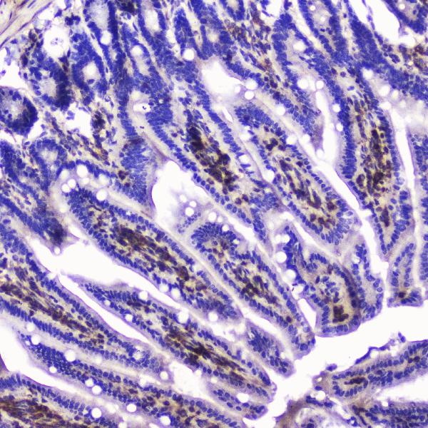 IHC analysis of Talin 1 using anti-Talin 1 antibody (A02859-1). Talin 1 was detected in paraffin-embedded section of mouse small intestine tissue. Heat mediated antigen retrieval was performed in citrate buffer (pH6, epitope retrieval solution) for 20 mins. The tissue section was blocked with 10% goat serum. The tissue section was then incubated with 2μg/ml rabbit anti-Talin 1 Antibody (A02859-1) overnight at 4℃. Biotinylated goat anti-rabbit IgG was used as secondary antibody and incubated for 30 minutes at 37℃. The tissue section was developed using Strepavidin-Biotin-Complex (SABC)(Catalog # SA1022) with DAB as the chromogen.