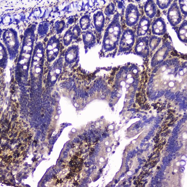 IHC analysis of Talin 1 using anti-Talin 1 antibody (A02859-1). Talin 1 was detected in paraffin-embedded section of rat small intestine tissue. Heat mediated antigen retrieval was performed in citrate buffer (pH6, epitope retrieval solution) for 20 mins. The tissue section was blocked with 10% goat serum. The tissue section was then incubated with 2μg/ml rabbit anti-Talin 1 Antibody (A02859-1) overnight at 4°C. Biotinylated goat anti-rabbit IgG was used as secondary antibody and incubated for 30 minutes at 37°C. The tissue section was developed using Strepavidin-Biotin-Complex (SABC)(Catalog # SA1022) with DAB as the chromogen.