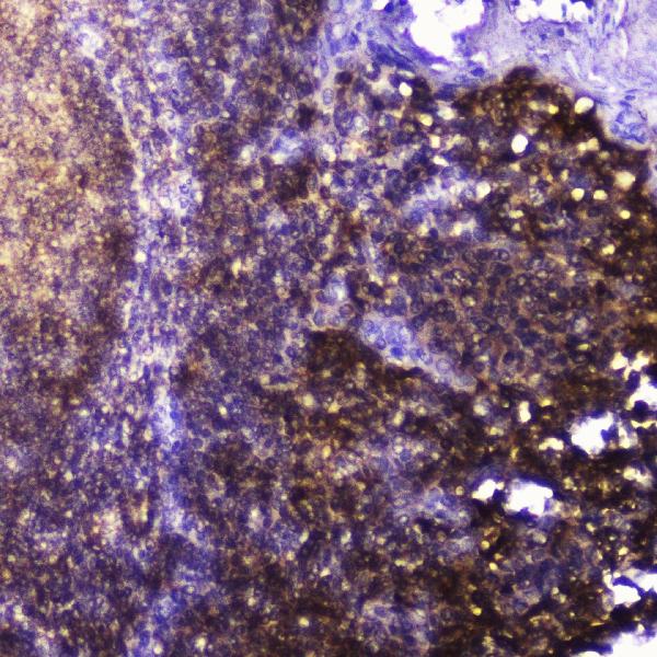IHC analysis of Talin 1 using anti-Talin 1 antibody (A02859-1). Talin 1 was detected in paraffin-embedded section of human tonsil tissue. Heat mediated antigen retrieval was performed in citrate buffer (pH6, epitope retrieval solution) for 20 mins. The tissue section was blocked with 10% goat serum. The tissue section was then incubated with 2μg/ml rabbit anti-Talin 1 Antibody (A02859-1) overnight at 4°C. Biotinylated goat anti-rabbit IgG was used as secondary antibody and incubated for 30 minutes at 37°C. The tissue section was developed using Strepavidin-Biotin-Complex (SABC)(Catalog # SA1022) with DAB as the chromogen.