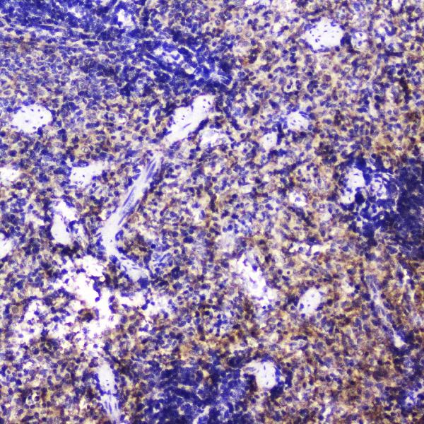 IHC analysis of Talin 1 using anti-Talin 1 antibody (A02859-1). Talin 1 was detected in paraffin-embedded section of mouse spleen tissue. Heat mediated antigen retrieval was performed in citrate buffer (pH6, epitope retrieval solution) for 20 mins. The tissue section was blocked with 10% goat serum. The tissue section was then incubated with 2μg/ml rabbit anti-Talin 1 Antibody (A02859-1) overnight at 4°C. Biotinylated goat anti-rabbit IgG was used as secondary antibody and incubated for 30 minutes at 37°C. The tissue section was developed using Strepavidin-Biotin-Complex (SABC)(Catalog # SA1022) with DAB as the chromogen.