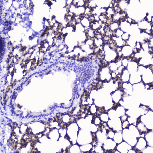 IHC analysis of Talin 1 using anti-Talin 1 antibody (A02859-1). Talin 1 was detected in paraffin-embedded section of rat lung tissue. Heat mediated antigen retrieval was performed in citrate buffer (pH6, epitope retrieval solution) for 20 mins. The tissue section was blocked with 10% goat serum. The tissue section was then incubated with 2μg/ml rabbit anti-Talin 1 Antibody (A02859-1) overnight at 4°C. Biotinylated goat anti-rabbit IgG was used as secondary antibody and incubated for 30 minutes at 37°C. The tissue section was developed using Strepavidin-Biotin-Complex (SABC)(Catalog # SA1022) with DAB as the chromogen.