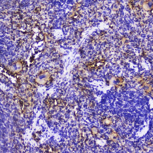IHC analysis of Talin 1 using anti-Talin 1 antibody (A02859-1). Talin 1 was detected in paraffin-embedded section of rat spleen tissue. Heat mediated antigen retrieval was performed in citrate buffer (pH6, epitope retrieval solution) for 20 mins. The tissue section was blocked with 10% goat serum. The tissue section was then incubated with 2μg/ml rabbit anti-Talin 1 Antibody (A02859-1) overnight at 4°C. Biotinylated goat anti-rabbit IgG was used as secondary antibody and incubated for 30 minutes at 37°C. The tissue section was developed using Strepavidin-Biotin-Complex (SABC)(Catalog # SA1022) with DAB as the chromogen.