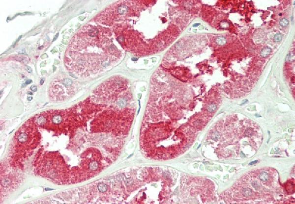 Immunohistochemical analysis of TRK Fused gene. Anti-TRK Fused gene antibody in human Kidney tissue at 20 &mu