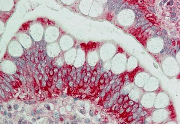 Immunohistochemical analysis of TRK Fused gene. Anti-TRK Fused gene antibody in human Small Intestine tissue at 20 &mu