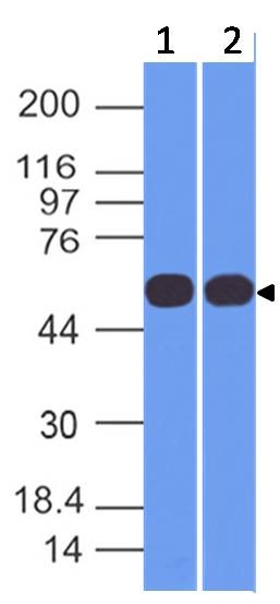 Western blot analysis of TRK Fused gene. Anti-TRK Fused gene antibody was used at 1 &mu