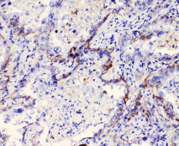 A02902 Integrin alpha 3 primary antibodies IHC testing 5