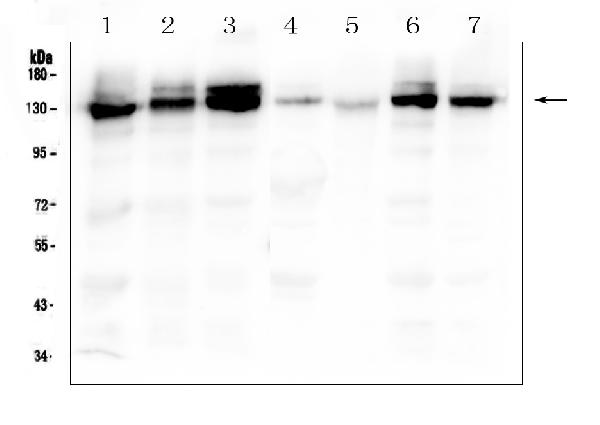Western blot analysis of Integrin alpha 3 using anti-Integrin alpha 3 antibody (A02902). Electrophoresis was performed on a 5-20% SDS-PAGE gel at 70V (Stacking gel) / 90V (Resolving gel) for 2-3 hours. The sample well of each lane was loaded with 50ug of sample under reducing conditions. Lane 1: human A549 whole cell lysate, Lane 2: human PC-3 whole cell lysate, Lane 3: human A431 whole cell lysate, Lane 4: human placenta tissue lysates, Lane 5: human SHG-44 whole cell lysate, Lane 6: human U20S whole cell lysate, Lane 7: human Hela whole cell lysate. After Electrophoresis, proteins were transferred to a Nitrocellulose membrane at 150mA for 50-90 minutes. Blocked the membrane with 5% Non-fat Milk/ TBS for 1.5 hour at RT. The membrane was incubated with rabbit anti-Integrin alpha 3 antigen affinity purified polyclonal antibody (Catalog # A02902) at 0.5 μg/mL overnight at 4°C, then washed with TBS-0.1%Tween 3 times with 5 minutes each and probed with a goat anti-rabbit IgG-HRP secondary antibody at a dilution of 1:10000 for 1.5 hour at RT. The signal is developed using an Enhanced Chemiluminescent detection (ECL) kit (Catalog # EK1002) with Tanon 5200 system. A specific band was detected for Integrin alpha 3 at approximately 130KD. The expected band size for Integrin alpha 3 is at 116KD.
