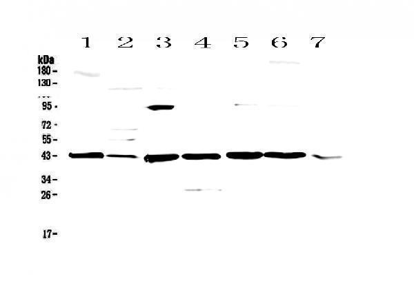  Western blot analysis of Caspase 4 using anti-Caspase 4 antibody (A02941-2)