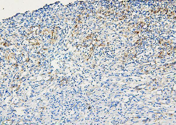  IHC analysis of ABCB5 using anti-ABCB5 antibody (A02979-1)