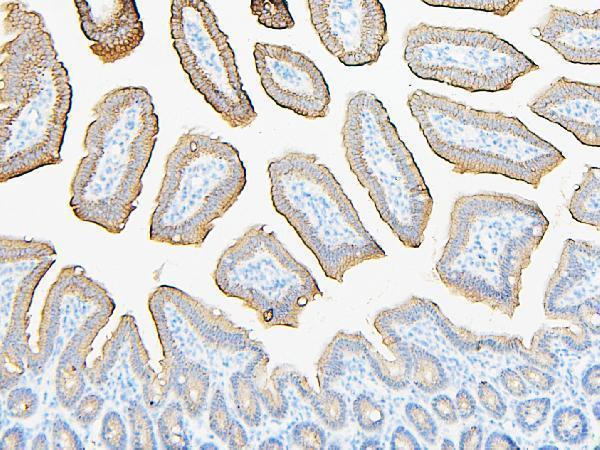  IHC analysis of ABCB5 using anti-ABCB5 antibody (A02979-1)