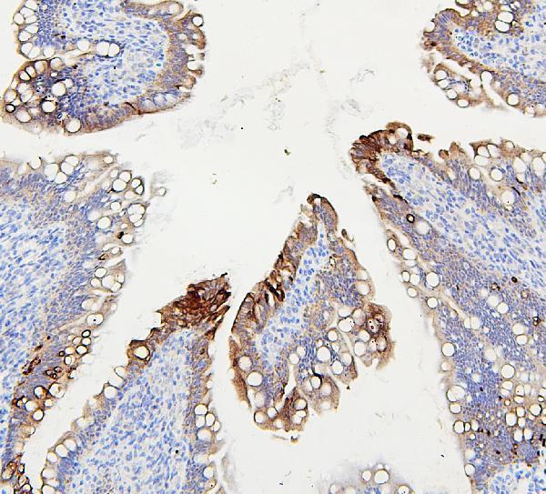  IHC analysis of ABCB5 using anti-ABCB5 antibody (A02979-1)