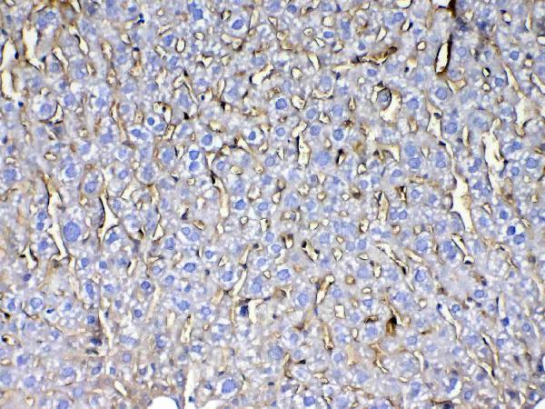 IHC analysis of CD105 using anti-CD105 antibody (A02997-2). CD105 was detected in paraffin-embedded section of mouse liver tissue. Heat mediated antigen retrieval was performed in citrate buffer (pH6, epitope retrieval solution) for 20 mins. The tissue section was blocked with 10% goat serum. The tissue section was then incubated with 1ug/ml rabbit anti-CD105 Antibody (A02997-2) overnight at 4 Biotinylated goat anti-rabbit IgG was used as secondary antibody and incubated for 30 minutes at 37 The tissue section was developed using Strepavidin-Biotin-Complex (SABC)(Catalog # SA1022) with DAB as the chromogen.