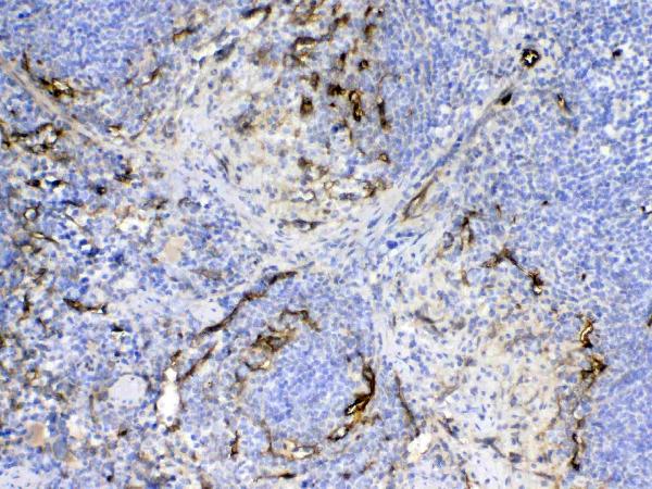 IHC analysis of CD105 using anti-CD105 antibody (A02997-2). CD105 was detected in paraffin-embedded section of mouse spleen tissue. Heat mediated antigen retrieval was performed in citrate buffer (pH6, epitope retrieval solution) for 20 mins. The tissue section was blocked with 10% goat serum. The tissue section was then incubated with 1ug/ml rabbit anti-CD105 Antibody (A02997-2) overnight at 4 Biotinylated goat anti-rabbit IgG was used as secondary antibody and incubated for 30 minutes at 37 The tissue section was developed using Strepavidin-Biotin-Complex (SABC)(Catalog # SA1022) with DAB as the chromogen.