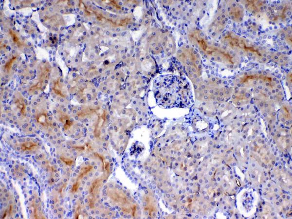 IHC analysis of CD105 using anti-CD105 antibody (A02997-2). CD105 was detected in paraffin-embedded section of rat kidney tissue. Heat mediated antigen retrieval was performed in citrate buffer (pH6, epitope retrieval solution) for 20 mins. The tissue section was blocked with 10% goat serum. The tissue section was then incubated with 1ug/ml rabbit anti-CD105 Antibody (A02997-2) overnight at 4 Biotinylated goat anti-rabbit IgG was used as secondary antibody and incubated for 30 minutes at 37 The tissue section was developed using Strepavidin-Biotin-Complex (SABC)(Catalog # SA1022) with DAB as the chromogen.